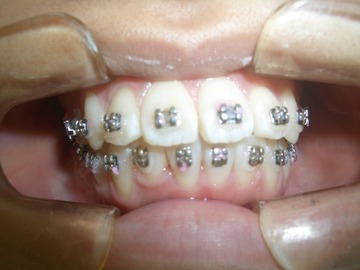 CIMG1112