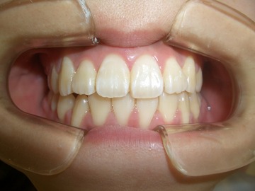 CIMG1058
