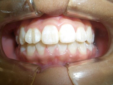 CIMG0893