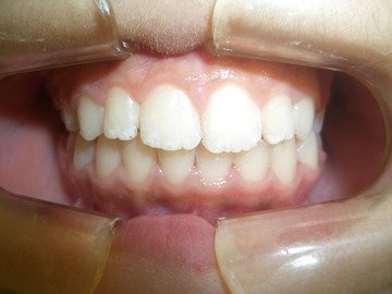 CIMG1125
