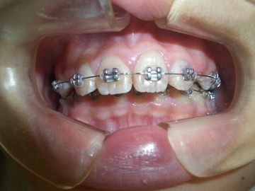 CIMG0656