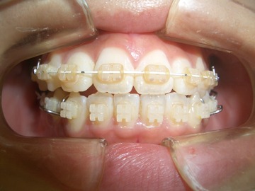 CIMG1098