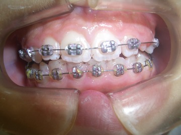 CIMG0984