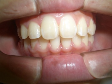 CIMG1129