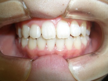CIMG1202