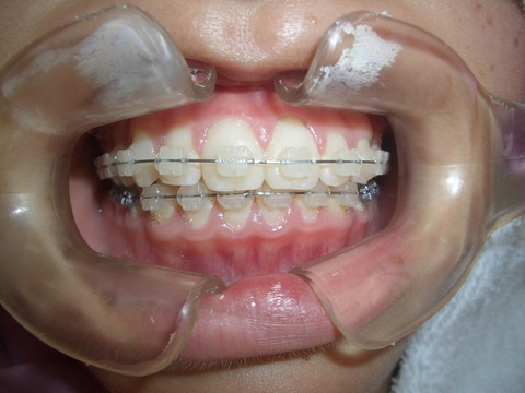 CIMG0091 - コピー