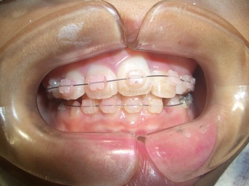 CIMG0106