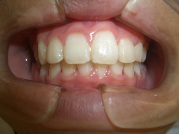 CIMG0667