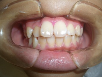 CIMG0834