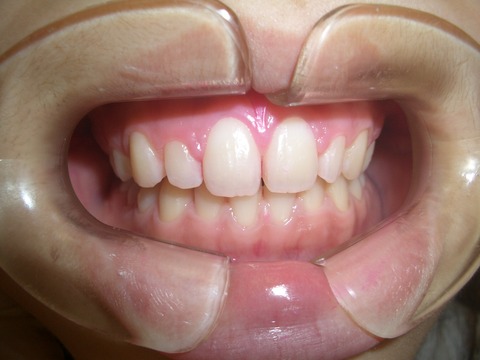 CIMG0274