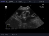 185--3_20120929_VET-_Abdom_0001