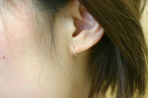 ピアストラブル 新潟市の皮膚科医のブログ