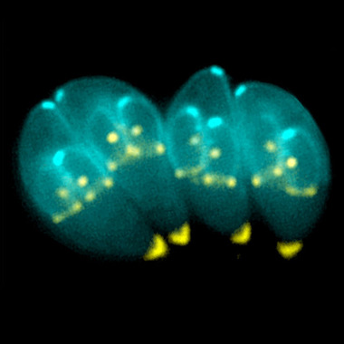 640px-Toxoplasma_gondii