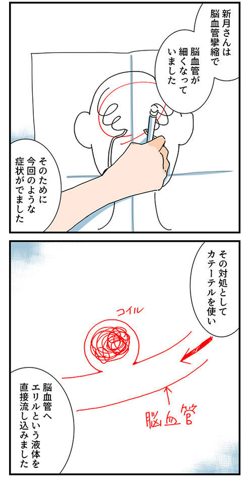 くも膜下出血のラブレター6話