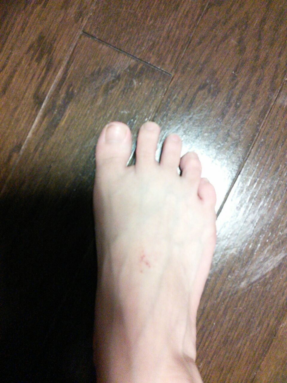 足の甲 Shiorinohietoriのblog