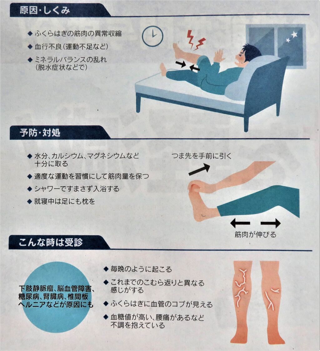 こむら返り 島爺と仲間たち