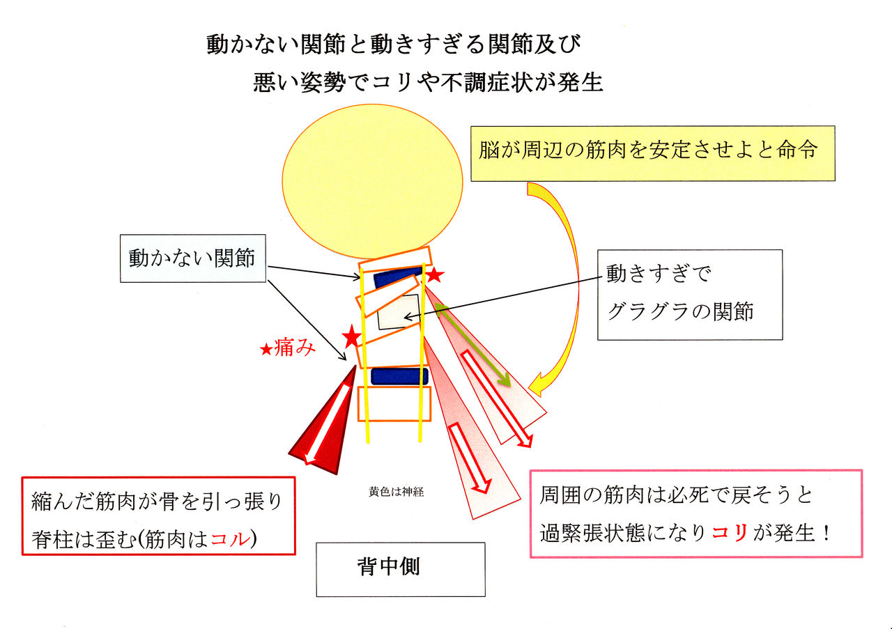 つい 首をボキボキ 気持ちがいいよね でも それって Shiseikairoofficeのblog