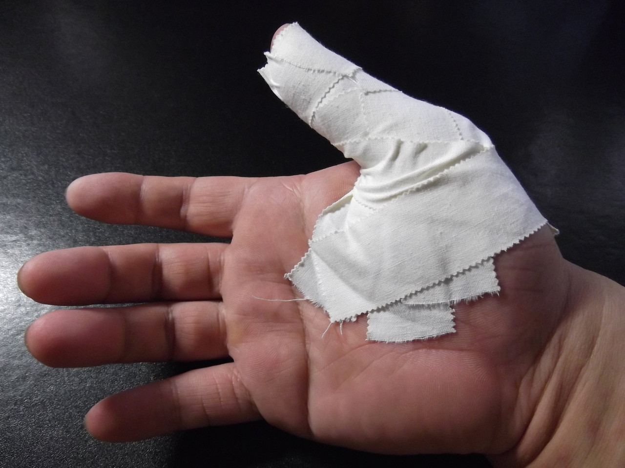 親指を固定するテーピングの方法 大人の発達障害と向き合う静葉ちゃんの試験室