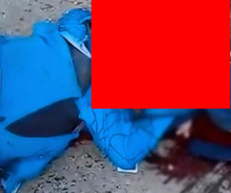 【閲覧注意】事故って即死したライダーから飛び出した心臓がビクンビクン動き続ける…