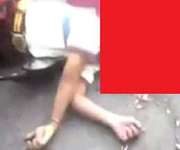 バイクに頭を潰された少年、頭がい骨が割れて脳みそが飛び出る…
