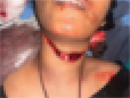 【閲覧注意】ギャングに斬首された女性 ⇒ 天才医師「これ元に戻せるよ」⇒ 凄すぎる画像