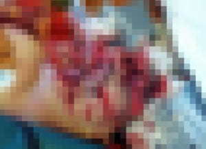 【超！閲覧注意】50代男性と交際していた20代男性、50代男性に浮気されこうする（１枚）