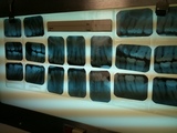 xray