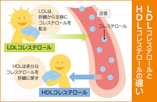 悪玉コレステロール 庶民のゴルフ