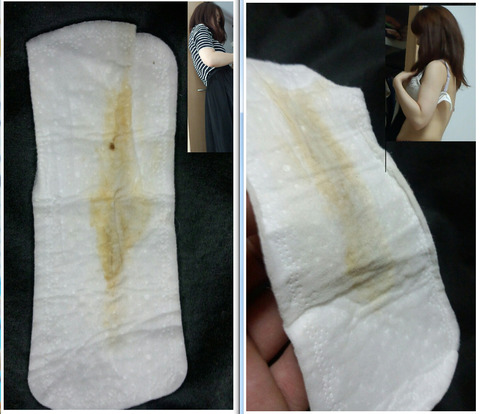 なぜ私の犬は臭いのでしょうか?