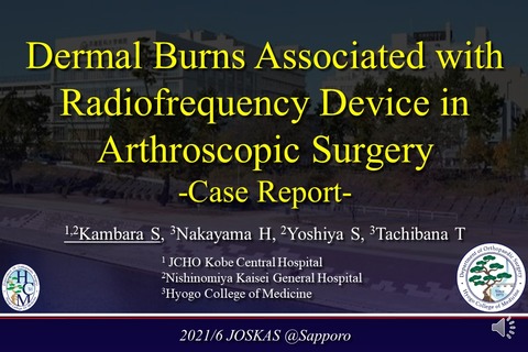 JOSKAS2021RFBurn2021.5.24