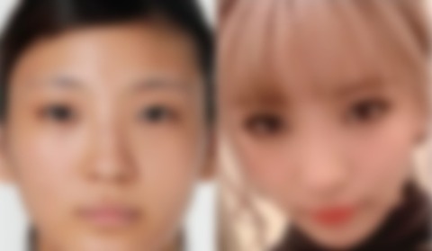 画像 ウーパールーパー と言われいじめられてた女性 整形を決意した結果 がんばりノート 2chまとめ 画像 ウーパールーパー と言われいじめられてた女性 整形を決意した結果 がんばりノート 2chまとめ