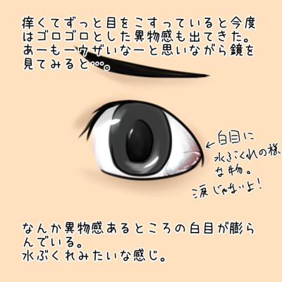 座敷童子の郷 目を掻きすぎた結果wwwww 座敷童子の郷 目を掻きすぎた結果wwwww