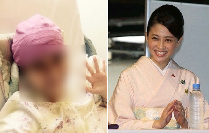 死去間近 小林麻央さんブログkokoro最新画像がやばい 2ch これ死相が出てるやん 余命宣告されたからアメブロ始めたのかな おもしろニュース速報