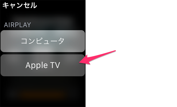 AppleWatchRemote28