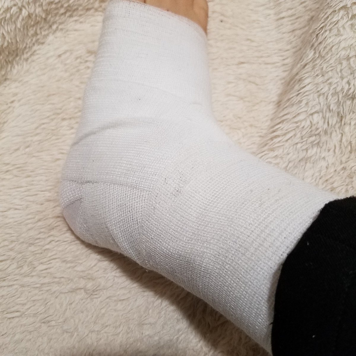 久しぶりの捻挫の記録 つぶやき