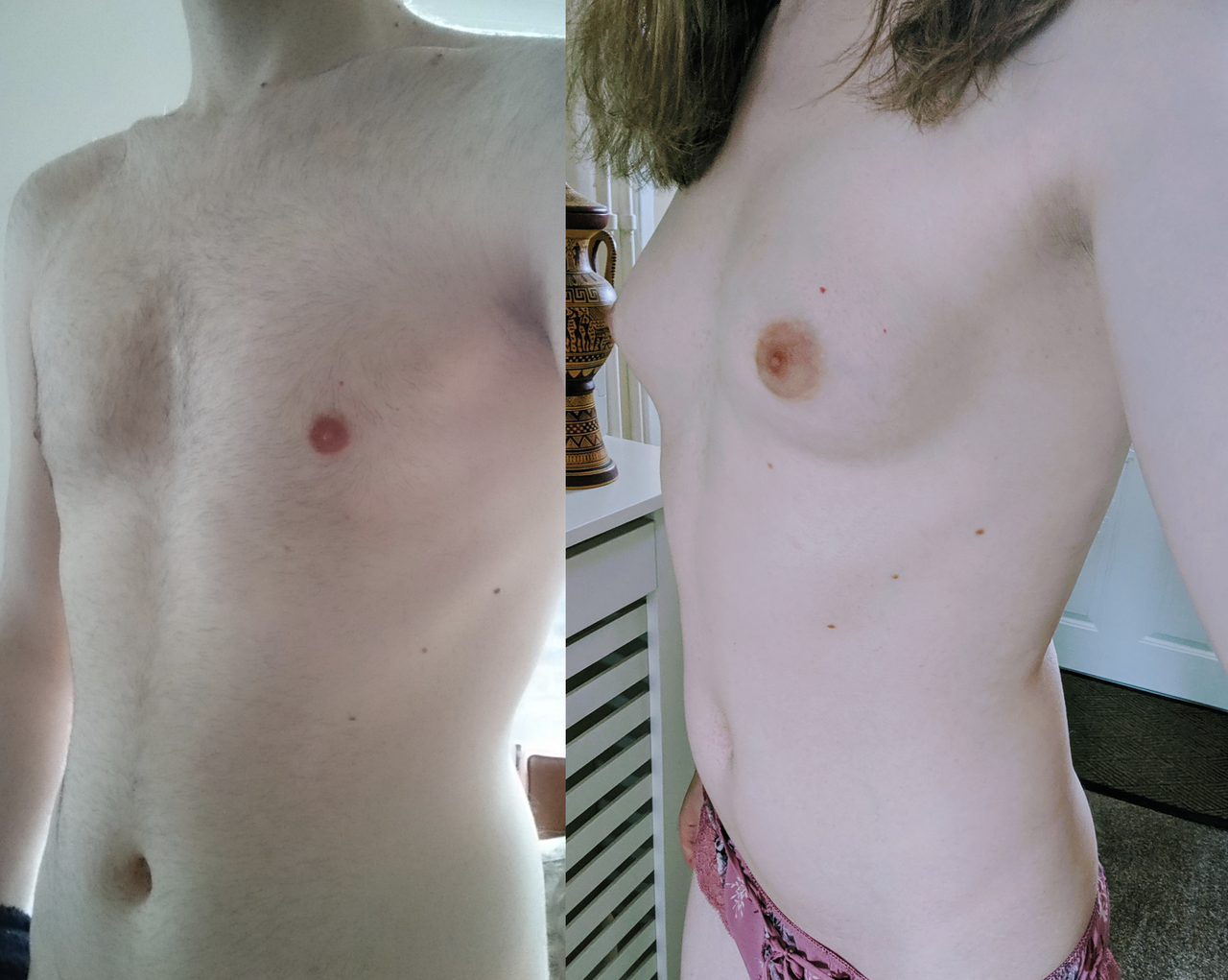 ＭＴＦ　全裸 女性ホルモン before&after part5 : ニューハーフ・男の娘研究所