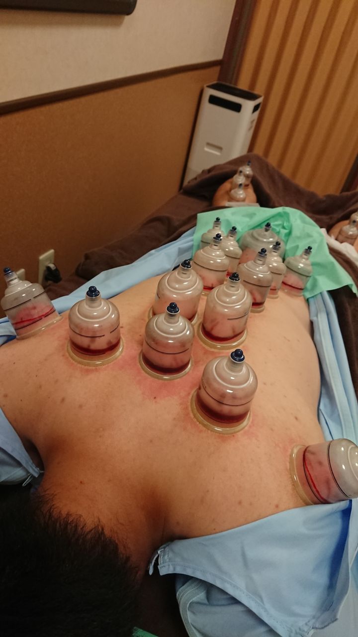 メディカルカッピング 格闘技 マッサージs Keep公式ブログ
