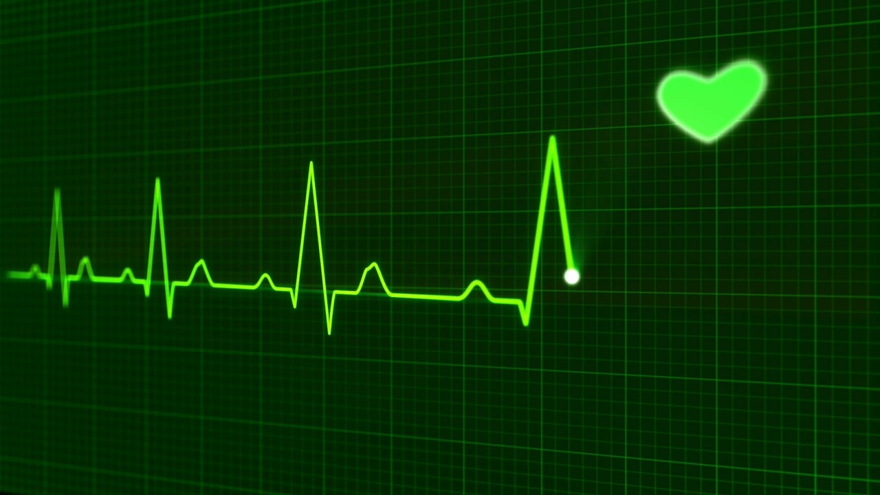 スマートウォッチの心拍計で心臓の異常な動きを98 検出できる研究論文が発表 心筋炎に罹ったことがある筆者から見た健康的な生活にウェアラブルが寄与できる可能性を検証 S Max スマートウォッチの心拍計で心臓の異常な動きを98 検出できる研究論文が発表 心筋炎に罹ったことがある筆者から見た健康的な生活にウェアラブルが寄与できる可能性を検証 S Max