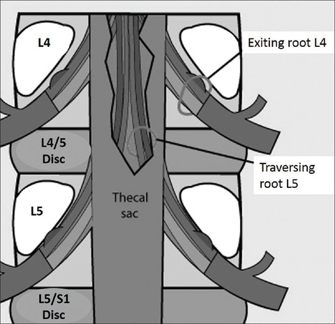 root