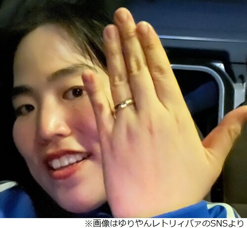【芸能】ゆりやんレトリィバァ、緊急会見で左手薬指に輝く謎のリング！結婚の噂が浮上