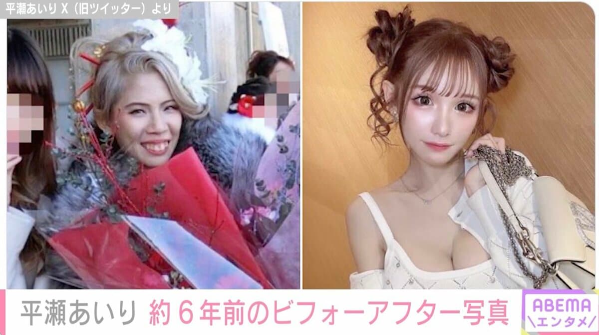 【平瀬あいり】2000万円の奇跡！整形前後の比較とコスプレ姿
