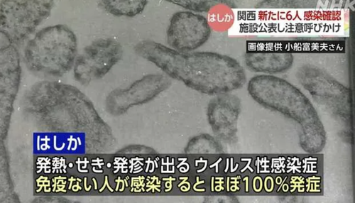 音楽・芸能 - 反ワクチンの自然派ママに育てられた女の子　地獄すぎる・・・