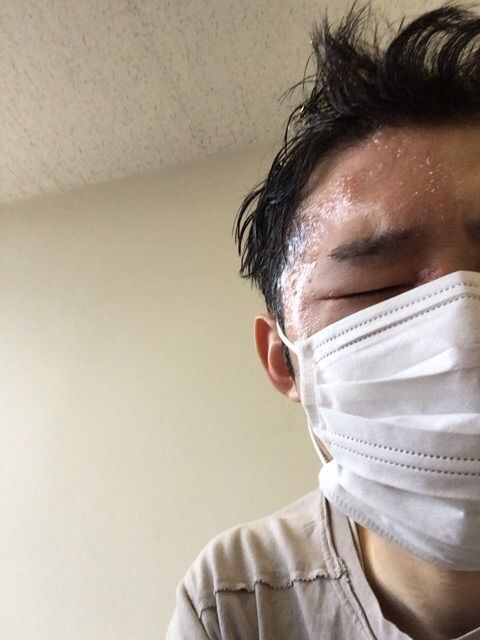 顔面または頭部に帯状疱疹ができてしまった方へ 顔面帯状疱疹 顔面または頭部に帯状疱疹ができてしまった方へ 顔面帯状疱疹