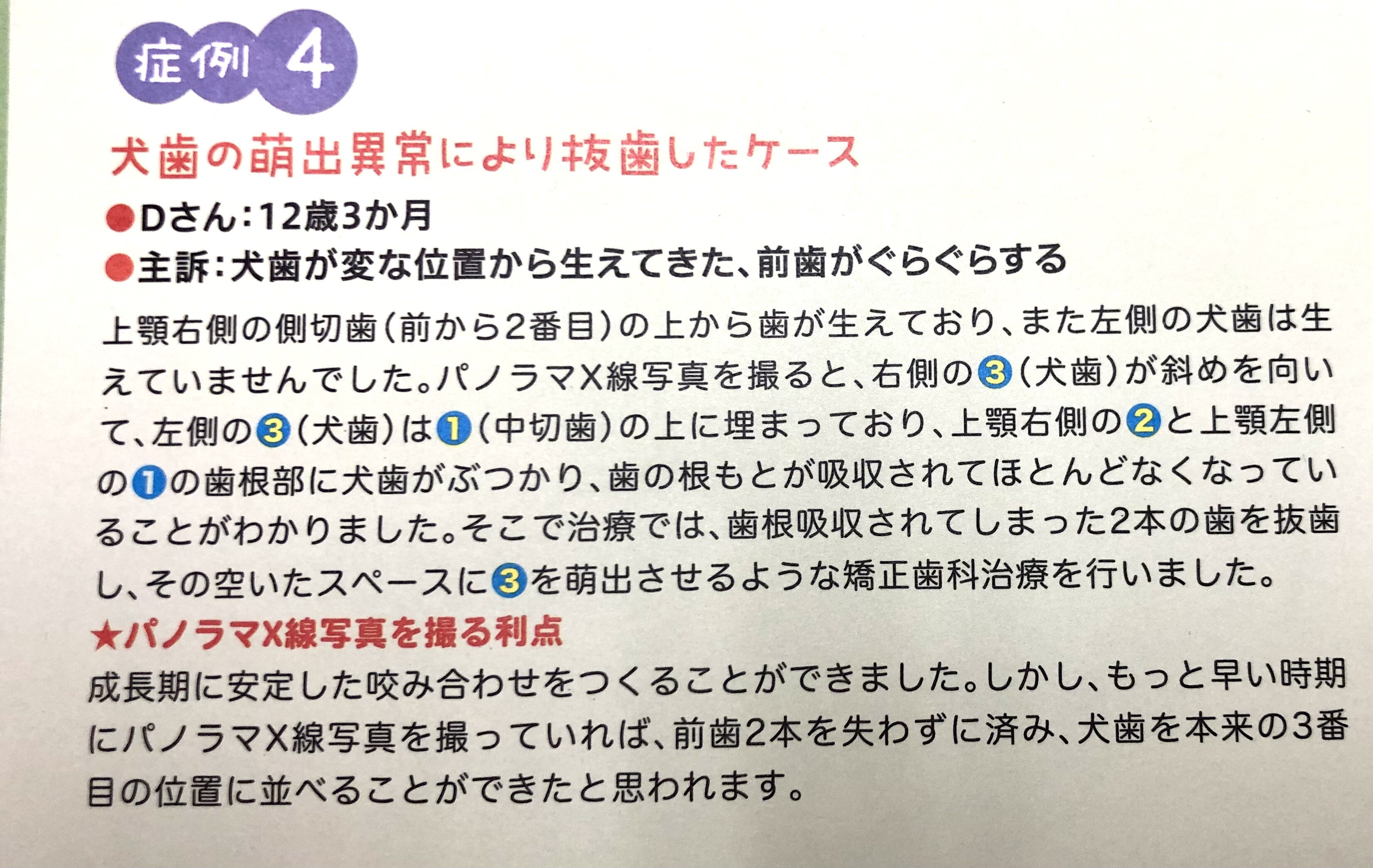 保護者に知って欲しい パノラマx線写真でわかる未来 Vol 5 静岡県 三島市 の矯正歯科 杉山矯正歯科 院内ブログ