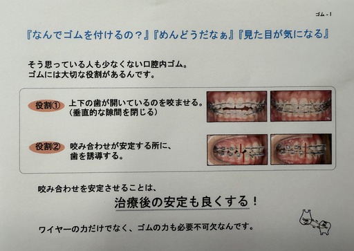 口腔内ゴムについて