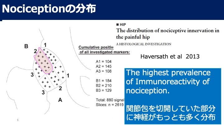 関節包を切開しない新しい股関節鏡視下手術 Vol 1. なぜ関節包を 関節包を切開しない新しい股関節鏡視下手術 Vol 1. なぜ関節包を