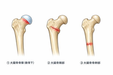 ChatGPT Image 2026ǯ1��3�� 16_27_48
