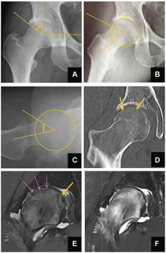 10.1177_23259671241294050-fig2