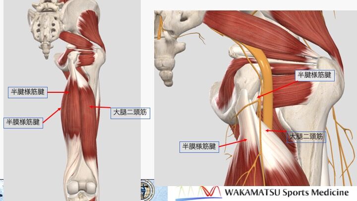 ハムストリング筋損傷の 総論 解剖から診断まで Vol 1 スポーツ整形外科医s Uのブログ Sports Physician S U Blog ハムストリング筋損傷の 総論 解剖から診断まで Vol 1 スポーツ整形外科医s Uのブログ Sports Physician S U Blog
