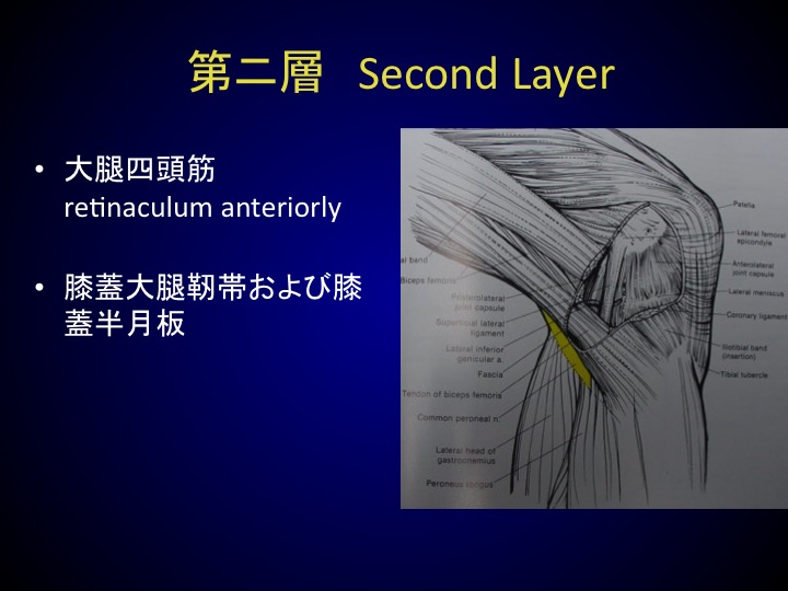 膝後外側構成体損傷 posterolateral rotational instability (PLRI 膝後外側構成体損傷 posterolateral rotational instability (PLRI